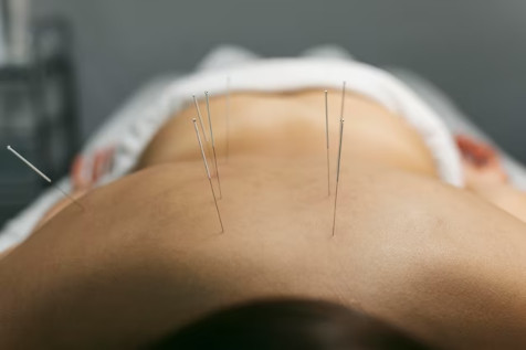 Apprenez comment l'acupuncture agit pour équilibrer l'énergie et soulager divers maux