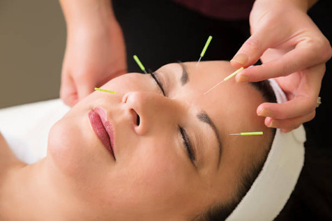 Le bien-être c'est aussi visible à l'extérieur. L'acupuncture peut contribuer à améliorer la santé de la peau du visage